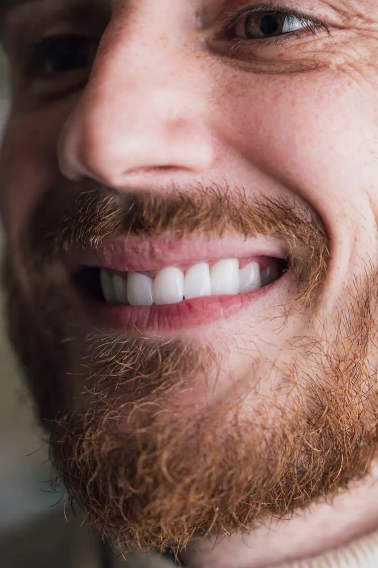 Smile Design