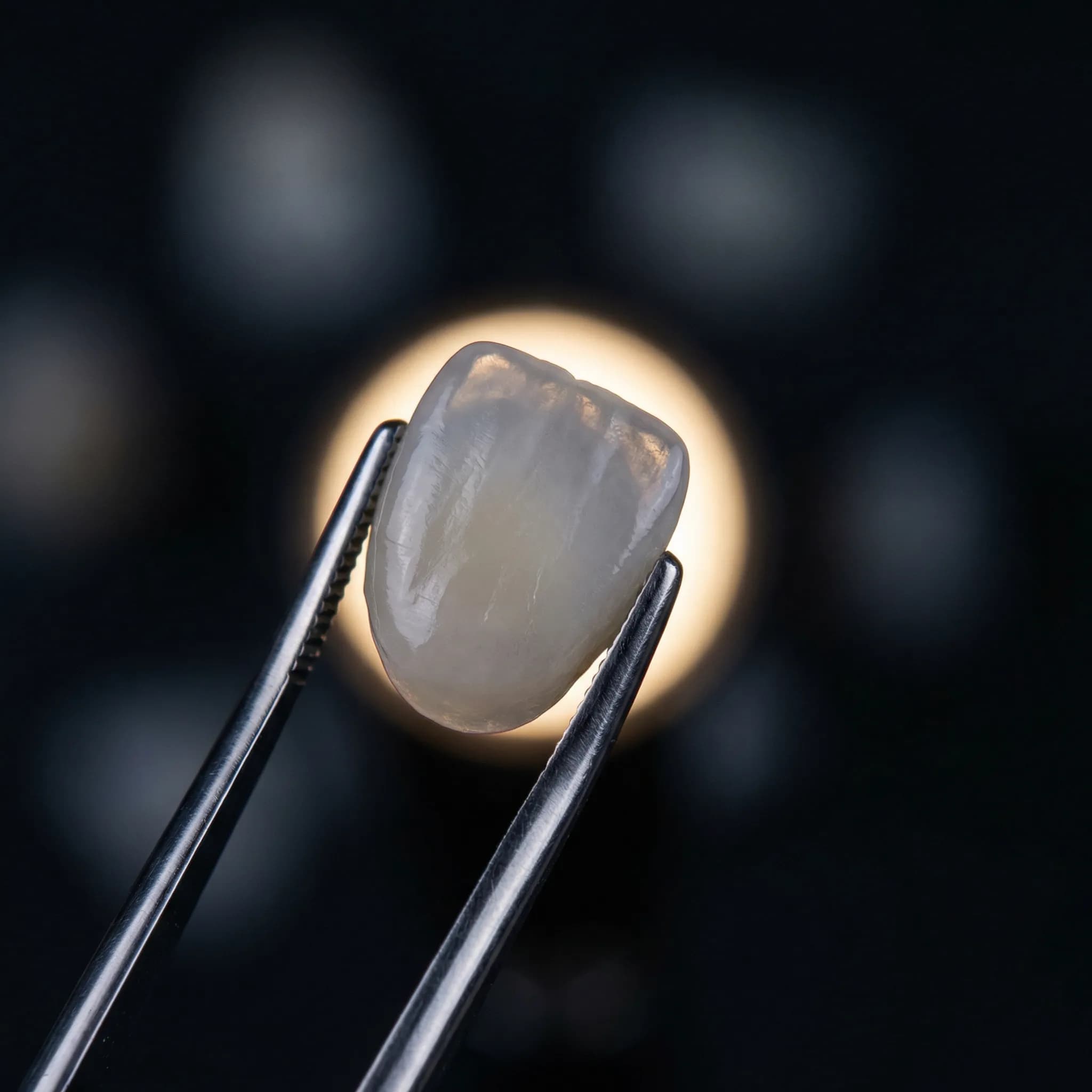 Zirconium Veneer