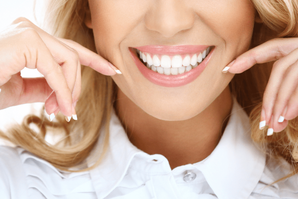 Smile Design 1 Aura Smile Studio smiledesing Aura Smile Studio